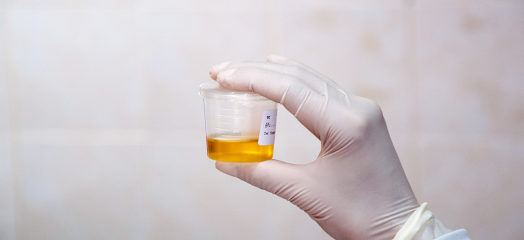 Urine-Drug-Test