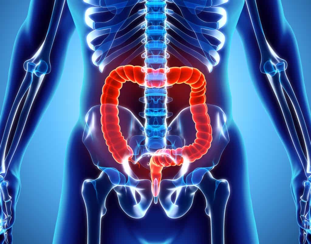 Colonic Irrigation