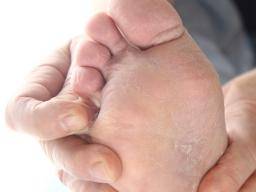 Foot infections